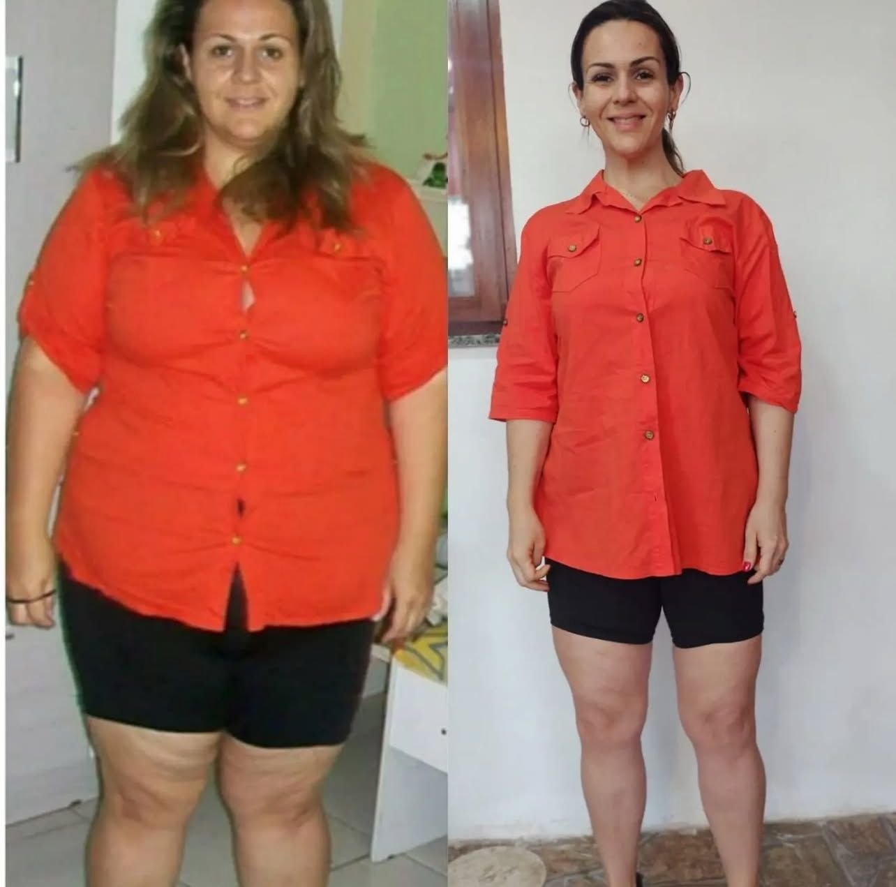 Antes y Después